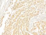 CPT1A Antibody in Immunohistochemistry (Paraffin) (IHC (P))