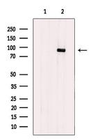 CPT1A Antibody in Western Blot (WB)