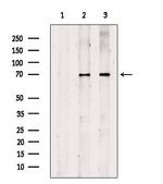 CPT1A Antibody in Western Blot (WB)