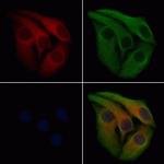 PADI2 Antibody in Immunocytochemistry (ICC/IF)