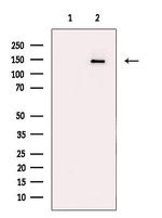 IFT140 Antibody in Western Blot (WB)