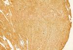 PLOD3 Antibody in Immunohistochemistry (Paraffin) (IHC (P))