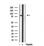 PLOD3 Antibody in Western Blot (WB)