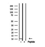 S100A14 Antibody in Western Blot (WB)