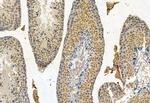 CRBN Antibody in Immunohistochemistry (Paraffin) (IHC (P))