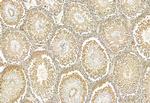 CRBN Antibody in Immunohistochemistry (Paraffin) (IHC (P))