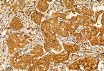 CHKA Antibody in Immunohistochemistry (Paraffin) (IHC (P))