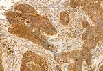 CHKA Antibody in Immunohistochemistry (Paraffin) (IHC (P))