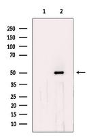 CHKA Antibody in Western Blot (WB)