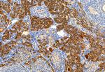 DHRS3 Antibody in Immunohistochemistry (Paraffin) (IHC (P))