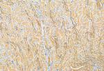 DHRS3 Antibody in Immunohistochemistry (Paraffin) (IHC (P))