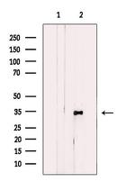 DHRS3 Antibody in Western Blot (WB)