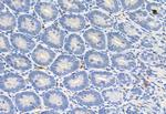 FKBP10 Antibody in Immunohistochemistry (Paraffin) (IHC (P))