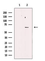 FKBP10 Antibody in Western Blot (WB)