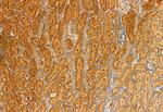 MCD Antibody in Immunohistochemistry (Paraffin) (IHC (P))