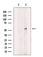 MCD Antibody in Western Blot (WB)