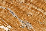 AP3B1 Antibody in Immunohistochemistry (Paraffin) (IHC (P))