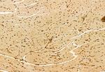 AP3B1 Antibody in Immunohistochemistry (Paraffin) (IHC (P))