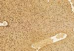 AP3B1 Antibody in Immunohistochemistry (Paraffin) (IHC (P))