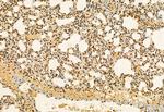 AP3B1 Antibody in Immunohistochemistry (Paraffin) (IHC (P))