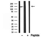 AP3B1 Antibody in Western Blot (WB)