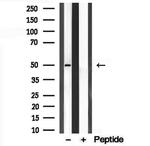 C9orf72 Antibody in Western Blot (WB)