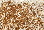 TCP-1 gamma Antibody in Immunohistochemistry (Paraffin) (IHC (P))