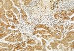 TCP-1 gamma Antibody in Immunohistochemistry (Paraffin) (IHC (P))