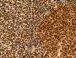 OGDH Antibody in Immunohistochemistry (Paraffin) (IHC (P))