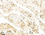 OGDH Antibody in Immunohistochemistry (Paraffin) (IHC (P))