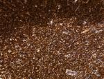 OGDH Antibody in Immunohistochemistry (Paraffin) (IHC (P))