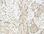 OGDH Antibody in Immunohistochemistry (Paraffin) (IHC (P))