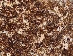 OGDH Antibody in Immunohistochemistry (Paraffin) (IHC (P))