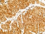 OGDH Antibody in Immunohistochemistry (Paraffin) (IHC (P))