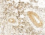 OGDH Antibody in Immunohistochemistry (Paraffin) (IHC (P))