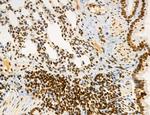 OGDH Antibody in Immunohistochemistry (Paraffin) (IHC (P))