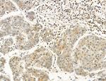 OGDH Antibody in Immunohistochemistry (Paraffin) (IHC (P))