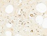 OGDH Antibody in Immunohistochemistry (Paraffin) (IHC (P))