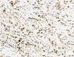 OGDH Antibody in Immunohistochemistry (Paraffin) (IHC (P))