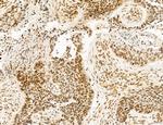 OGDH Antibody in Immunohistochemistry (Paraffin) (IHC (P))