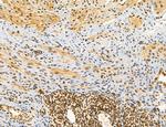 OGDH Antibody in Immunohistochemistry (Paraffin) (IHC (P))