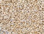 OGDH Antibody in Immunohistochemistry (Paraffin) (IHC (P))