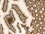 OGDH Antibody in Immunohistochemistry (Paraffin) (IHC (P))