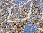 SEC61G Antibody in Immunohistochemistry (Paraffin) (IHC (P))