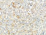 SEC61G Antibody in Immunohistochemistry (Paraffin) (IHC (P))