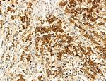 SEC61G Antibody in Immunohistochemistry (Paraffin) (IHC (P))