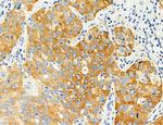 SEC61G Antibody in Immunohistochemistry (Paraffin) (IHC (P))