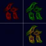 PEX16 Antibody in Immunocytochemistry (ICC/IF)