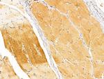 SYNPO2 Antibody in Immunohistochemistry (Paraffin) (IHC (P))