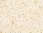 TAF12 Antibody in Immunohistochemistry (Paraffin) (IHC (P))